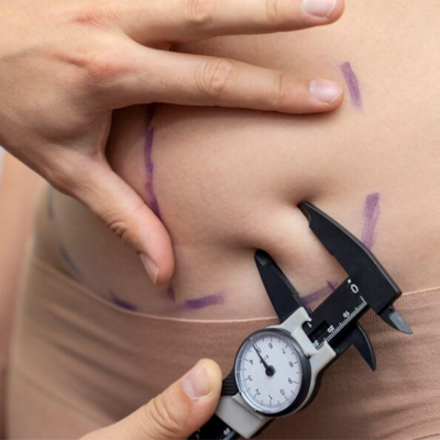 Swelling Excision